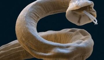 Parásito Ascaris en el cuerpo humano
