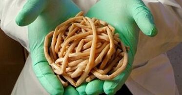 Parásitos extraídos del cuerpo humano.