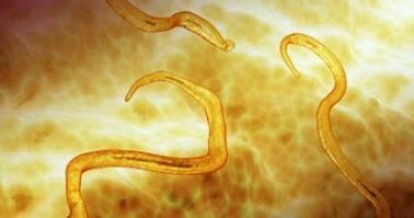 Parásitos oxiuros en el cuerpo humano.