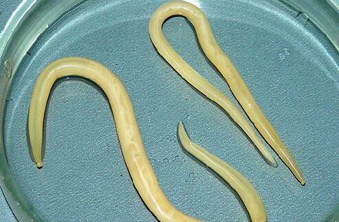 Lombrices intestinales del cuerpo de un niño.