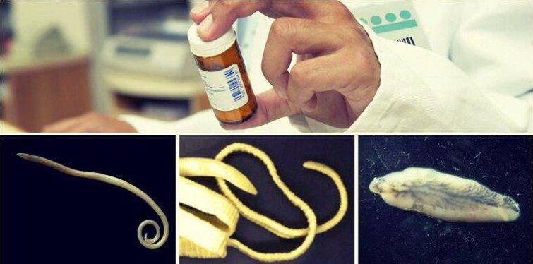 Tipos de gusanos y método médico para deshacerse de ellos